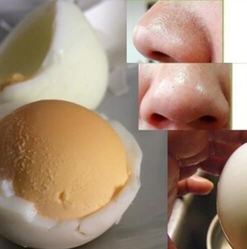 Trứng gà luộc và trứng gà sống đều có thể lột mụn đầu đen