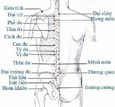 Cách châm cứu chữa trị đau lưng